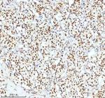 Ku70 Antibody in Immunohistochemistry (Paraffin) (IHC (P))