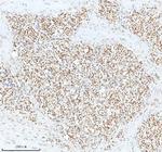 Ku70 Antibody in Immunohistochemistry (Paraffin) (IHC (P))