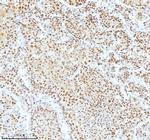 Ku70 Antibody in Immunohistochemistry (Paraffin) (IHC (P))