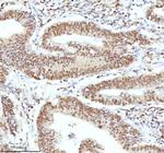 Ku70 Antibody in Immunohistochemistry (Paraffin) (IHC (P))
