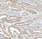 Ku70 Antibody in Immunohistochemistry (Paraffin) (IHC (P))
