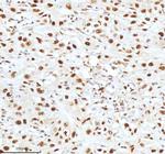 Ku70 Antibody in Immunohistochemistry (Paraffin) (IHC (P))
