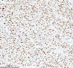 Ku70 Antibody in Immunohistochemistry (Paraffin) (IHC (P))