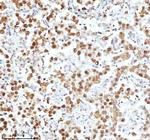 Ku70 Antibody in Immunohistochemistry (Paraffin) (IHC (P))