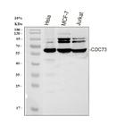 Cdc73 Polyclonal Antibody