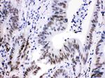 CDK9 Polyclonal Antibody