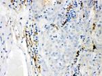 CYP1B1 Polyclonal Antibody