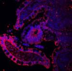 E-cadherin Antibody in Immunohistochemistry (Paraffin) (IHC (P))