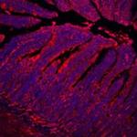 E-cadherin Antibody in Immunohistochemistry (Paraffin) (IHC (P))