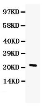 G-CSF Polyclonal Antibody