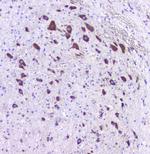 HTR2A Antibody in Immunohistochemistry (Paraffin) (IHC (P))
