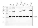 Cofilin Antibody in Western Blot (WB)