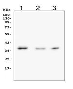 Galectin 8 Polyclonal Antibody