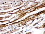 SHP2 Polyclonal Antibody