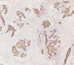 Cytokeratin 19 Antibody in Immunohistochemistry (Paraffin) (IHC (P))