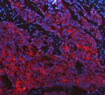 Cytokeratin 19 Antibody in Immunohistochemistry (Paraffin) (IHC (P))