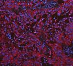 Cytokeratin 19 Antibody in Immunohistochemistry (Paraffin) (IHC (P))