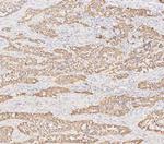 Cytokeratin 19 Antibody in Immunohistochemistry (Paraffin) (IHC (P))