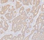 Cytokeratin 19 Antibody in Immunohistochemistry (Paraffin) (IHC (P))