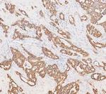 Cytokeratin 19 Antibody in Immunohistochemistry (Paraffin) (IHC (P))