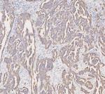 Cytokeratin 19 Antibody in Immunohistochemistry (Paraffin) (IHC (P))