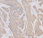 Cytokeratin 19 Antibody in Immunohistochemistry (Paraffin) (IHC (P))