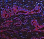 Cytokeratin 19 Antibody in Immunohistochemistry (Paraffin) (IHC (P))