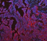 Cytokeratin 19 Antibody in Immunohistochemistry (Paraffin) (IHC (P))