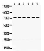 LIMK2 Polyclonal Antibody