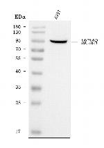 MCM8 Polyclonal Antibody