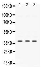 AMPK beta-1 Antibody in Western Blot (WB)
