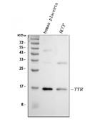 Transthyretin Antibody in Western Blot (WB)
