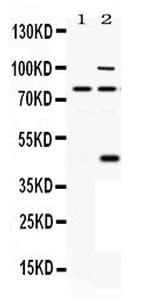 PCSK6 Polyclonal Antibody
