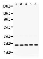RAB18 Polyclonal Antibody