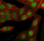 RbAp48 Polyclonal Antibody