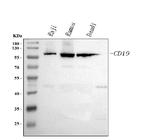 CD19 Antibody in Western Blot (WB)