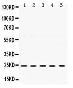 TIMP2 Polyclonal Antibody