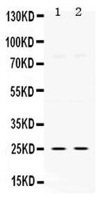 TK1 Polyclonal Antibody