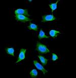 Galectin 1 Polyclonal Antibody