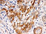 SFRP4 Polyclonal Antibody
