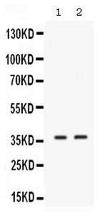 SIX1 Polyclonal Antibody