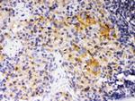 SKAP55 Polyclonal Antibody