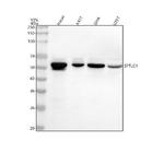 SPTLC1 Antibody in Western Blot (WB)