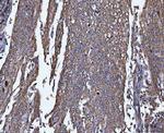 TRPM4 Polyclonal Antibody
