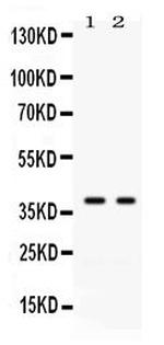 Galectin 4 Antibody in Western Blot (WB)