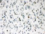 MEF2A Antibody in Immunohistochemistry (Paraffin) (IHC (P))