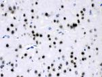 MEF2A Antibody in Immunohistochemistry (Paraffin) (IHC (P))