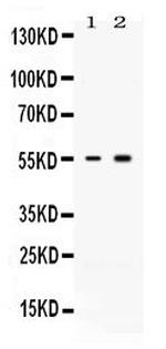 ACVR2B Polyclonal Antibody