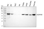 ALDH1A2 Antibody in Western Blot (WB)
