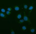 AMACR Polyclonal Antibody